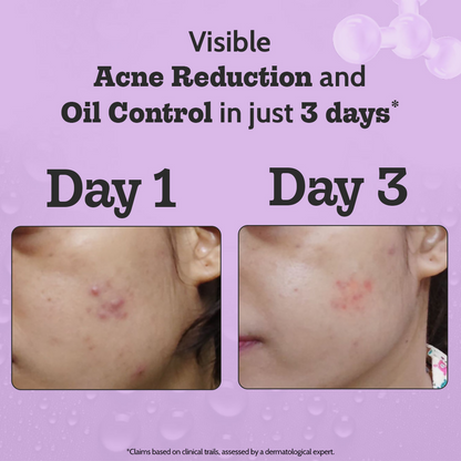 Chemist At Play 2% Salicylic Acid Face Serum