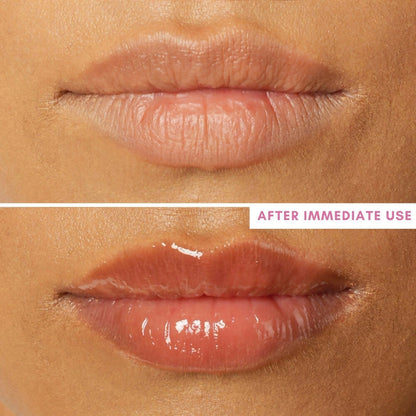 The Skin Diet Company Lip Barrier Oil Clear Gloss with Peptides Hydrates, For Dry & Pigmented Lips