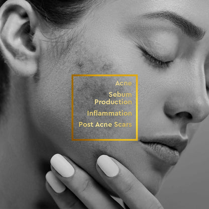 VLCC Clinic Acne Control Regime CSMS (Cleanser, Serum, Moisturizer, Sunscreen) For Acne Care Combo