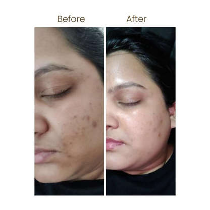 Personal Touch Mucin Serum With Hyaluronic Acids, Ceramides & Niacinamide