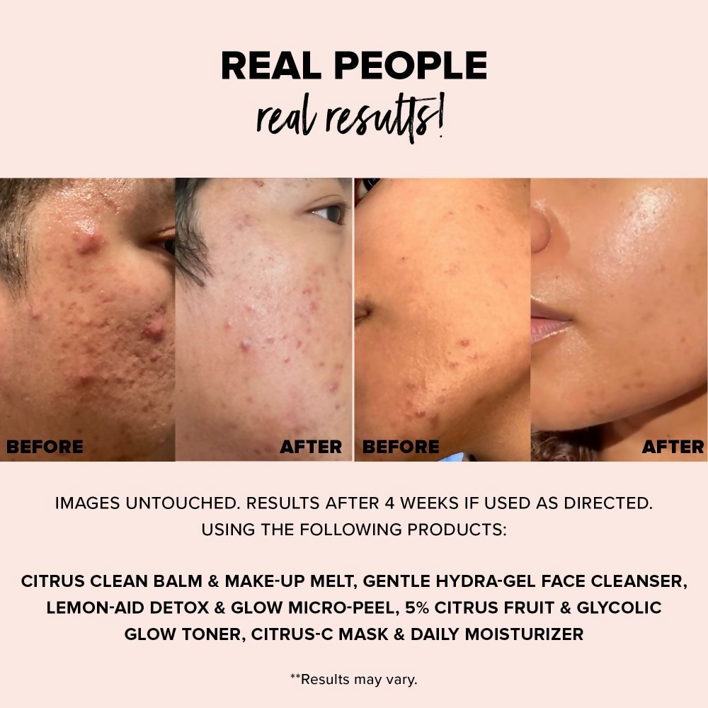 Nudestix Nudeskin Gentle Hydra-Gel Face Cleanser