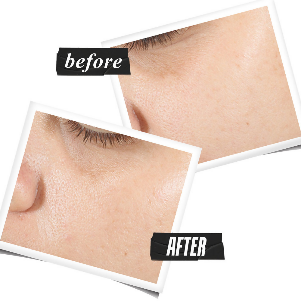 Kiehl's Ultra Pure High-Potency Serum with 1.5% Hyaluronic Acid