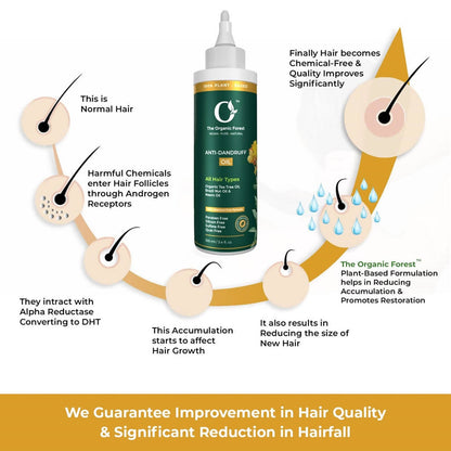 The Organic Forest Anti-Dandruff Oil - Drmedicart