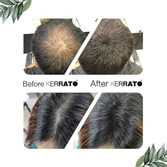 Kerrato Hair Fibres For Thinning Hair - Jet Black