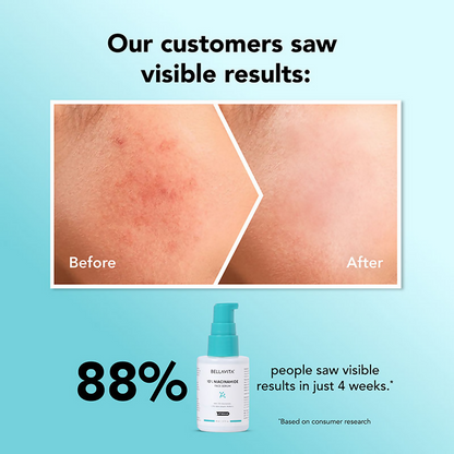 Bella Vita Organic Niacinamide Face Serum