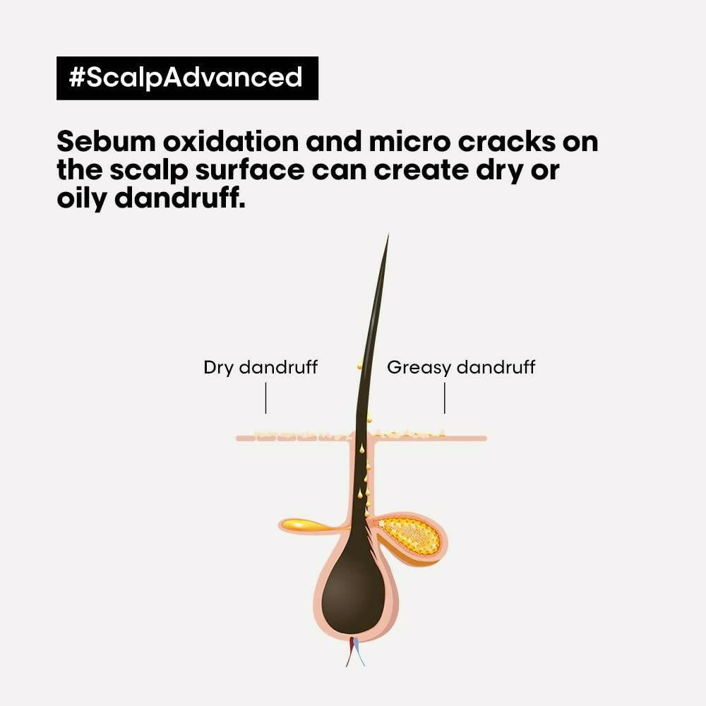 L'Or??al Paris Scalp Advanced Anti-Dandruff Dermo-Clarifier Shampoo & Liss Unlimited Hair Mask