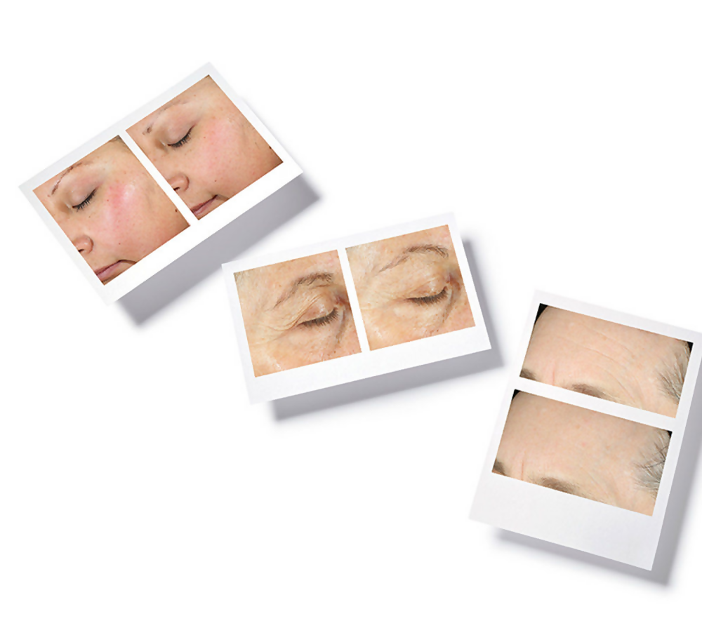 Murad Hydration Intense Recovery Cream