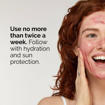 The Ordinary AHA 30% + BHA 2% Peeling Solution Serum