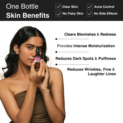 Soulflower Rosemary Oil for Healthy Hair and Shiny Skin