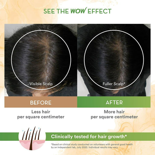 Buy Wow Skin Science Rosemary Essential Oil from DrMediCart, Ship from India to USA