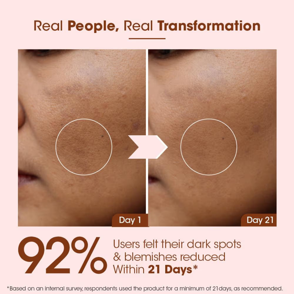 TAC - The Ayurveda Co. 100% Pure Kumkumadi Gold Glow Face Oil For Glowing, Youthful & Radiant Skin