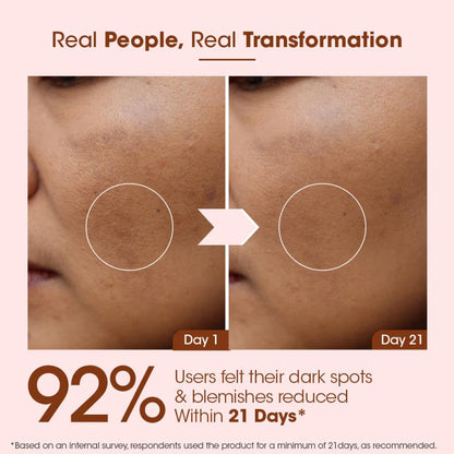 TAC - The Ayurveda Co. 100% Pure Kumkumadi Gold Glow Face Oil For Glowing, Youthful & Radiant Skin