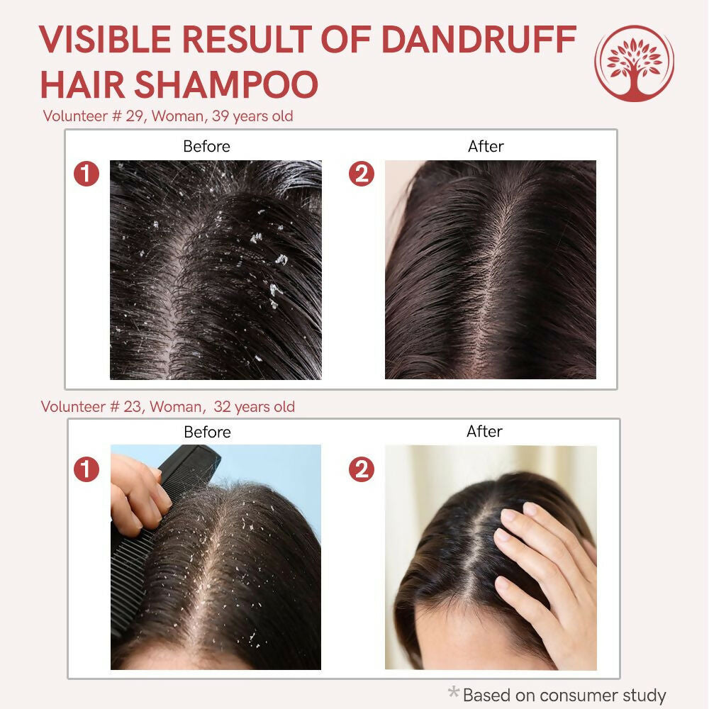 Ivory Natural Dandruff Shampoo - Embrace A Rejuvenated Scalp