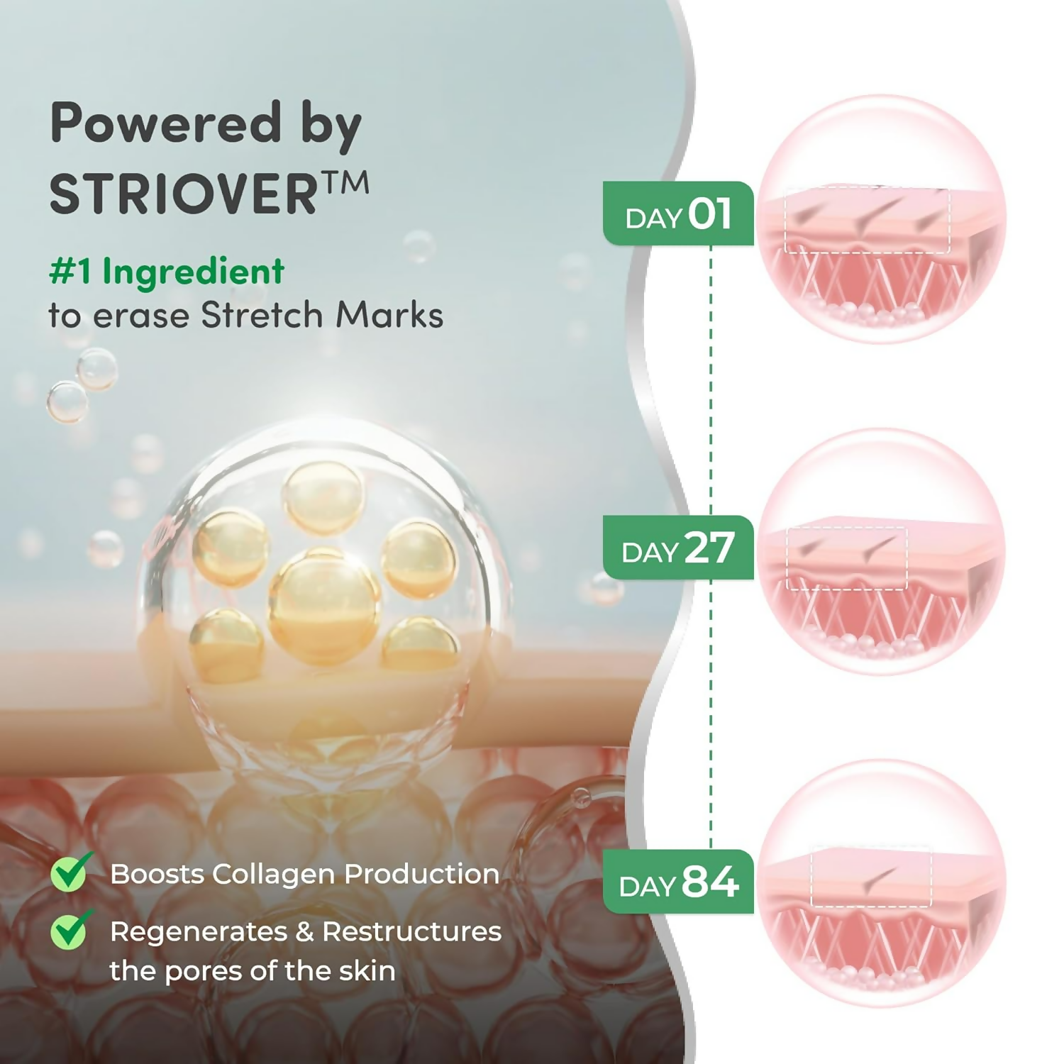 Mylo Care Stretch Marks Combo