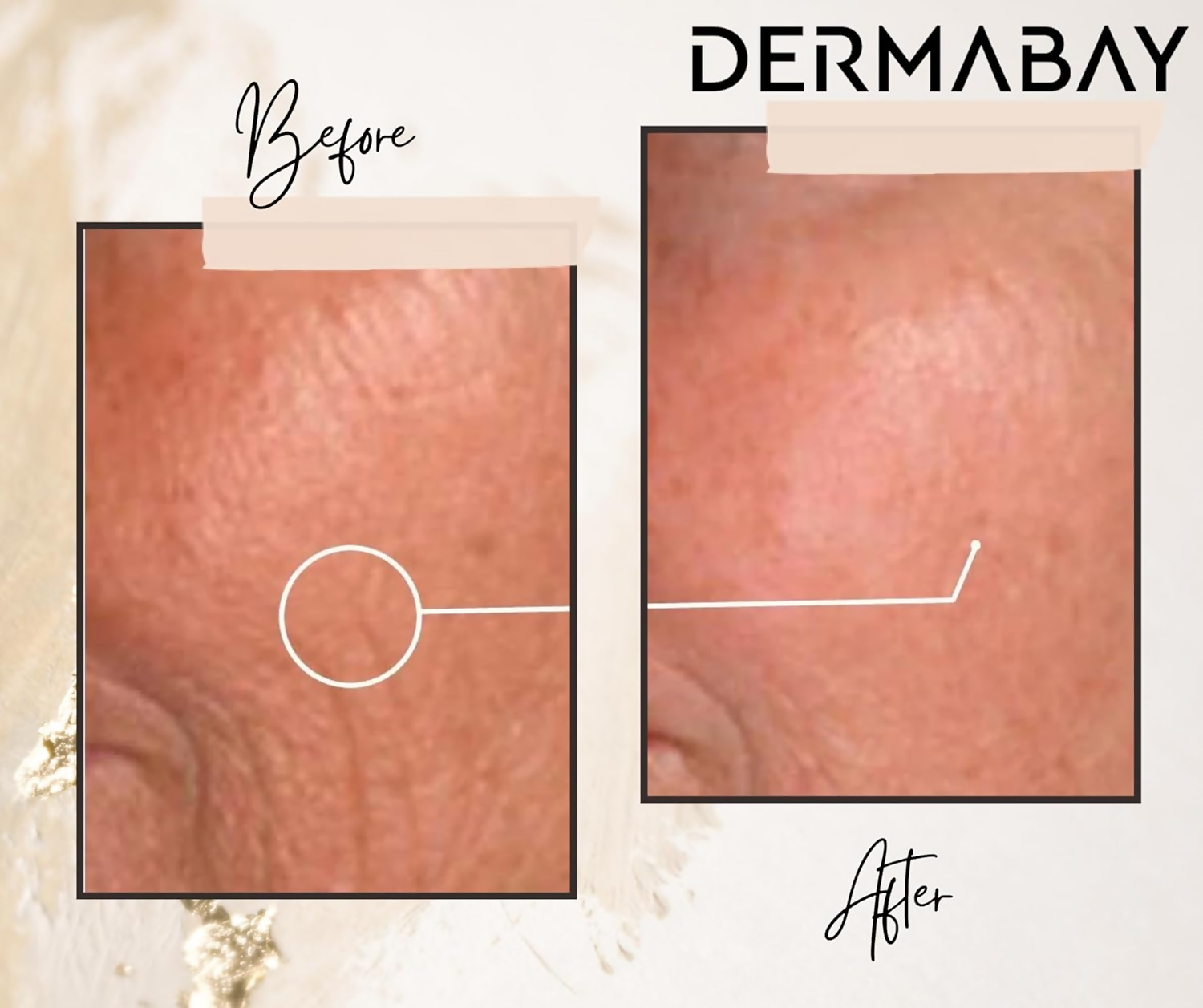 Dermabay Retinol 0.2% Face Serum
