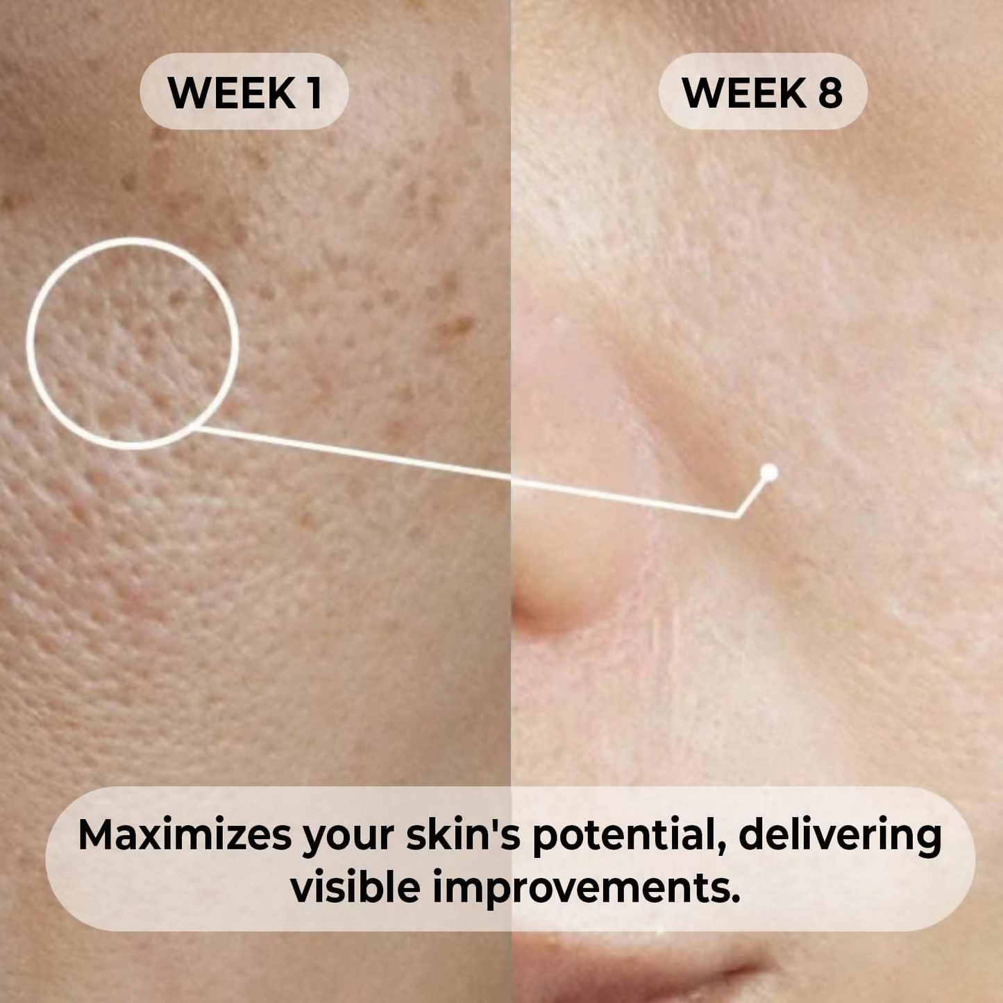 Dermabay Niacinamide 5%+ Hyaluronic acid 1% Serum