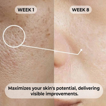 Dermabay Niacinamide 5%+ Hyaluronic acid 1% Serum