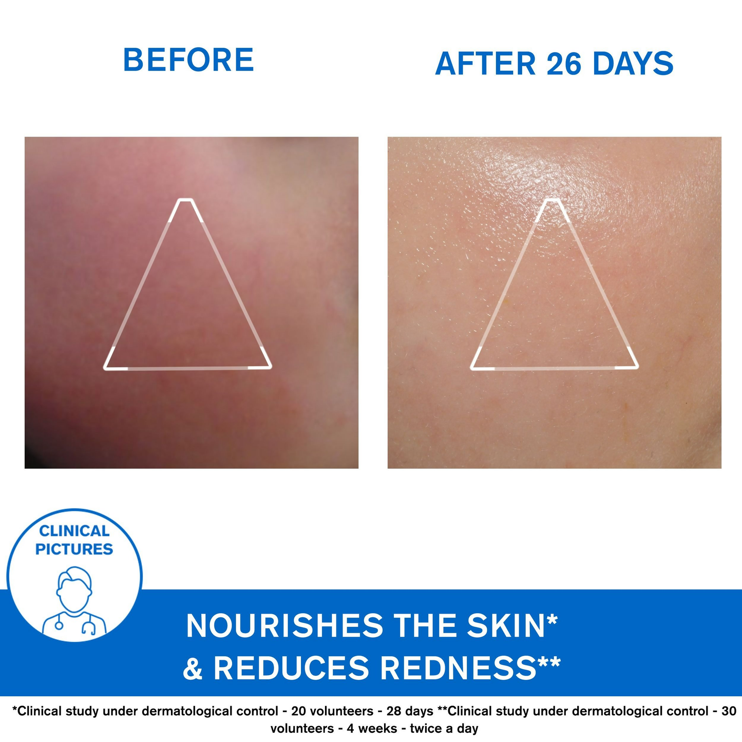 Uriage Xemose Face Cream
