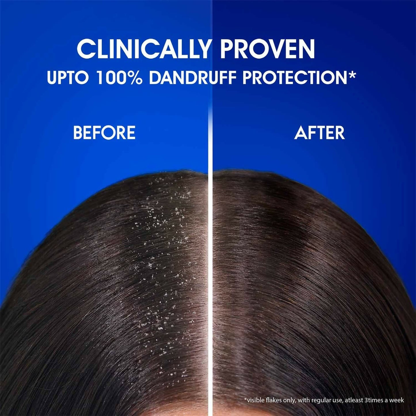 Head & Shoulders Silky Black Anti Dandruff Shampoo