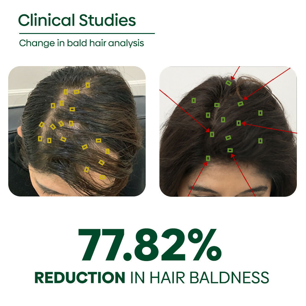 Rishi Natural Adivasi Hair Oil