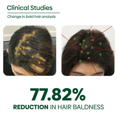 Rishi Natural Adivasi Hair Oil