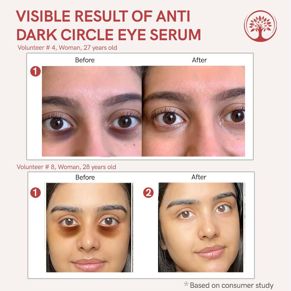 Ivory Natural Dark Circle Eye Serum For Dark Eye Circles, Under-Eye Patches, Swollen Eyes