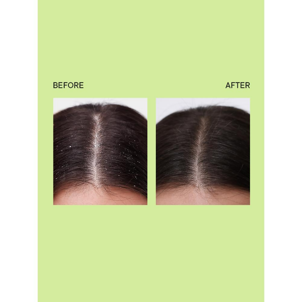 Quench Anti Dandruff Shampoo