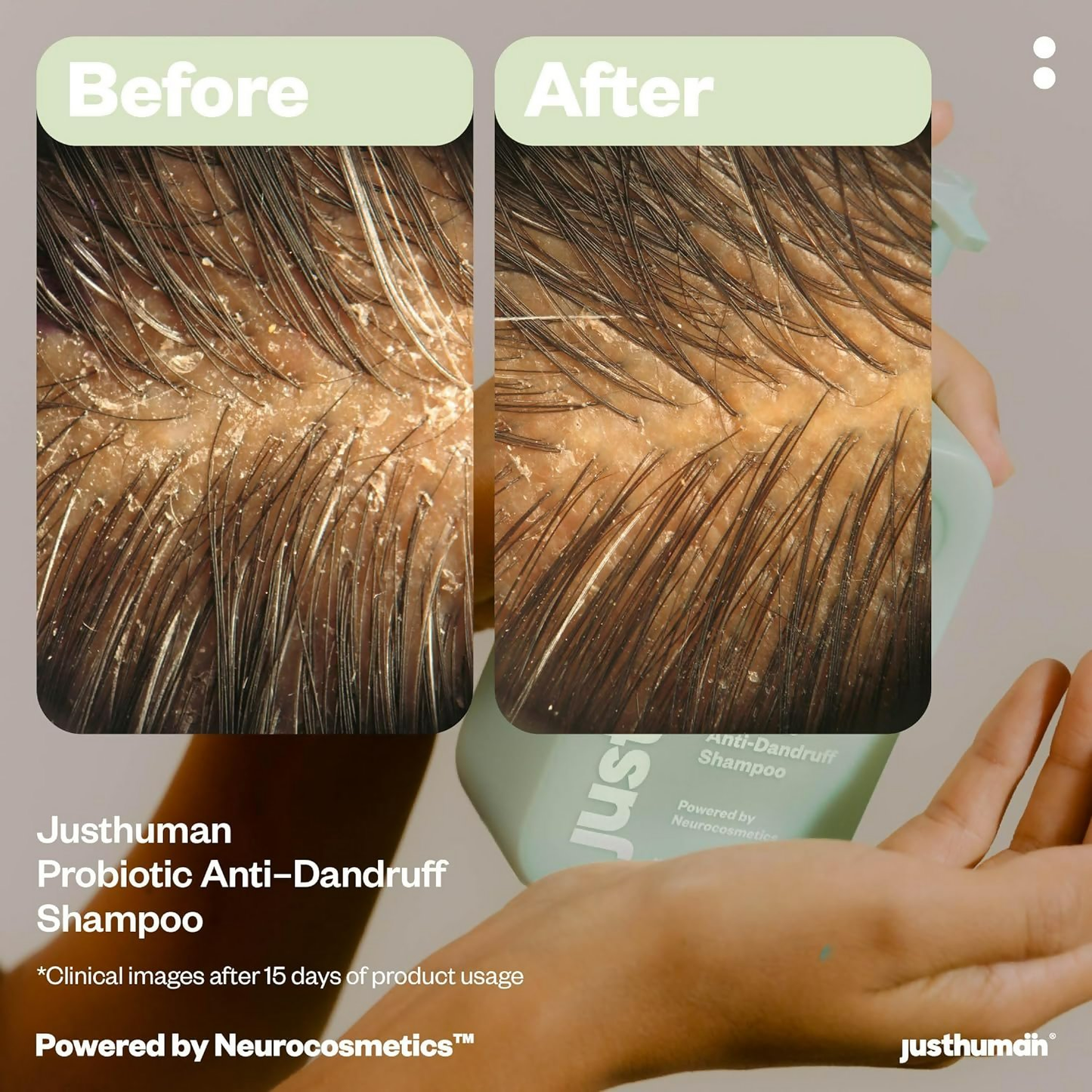 JustHuman Probiotic Anti Dandruff Shampoo