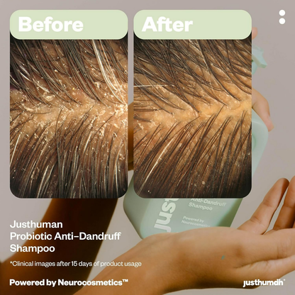 JustHuman Probiotic Anti Dandruff Shampoo