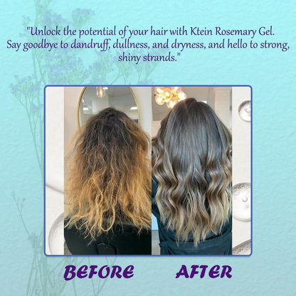 Ktein Rosemary Gel: 95% Rosemary Infused Hair Care Gel