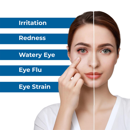 Satya Pharmaceuticals Ayurveda Al-Shams Eye Drops