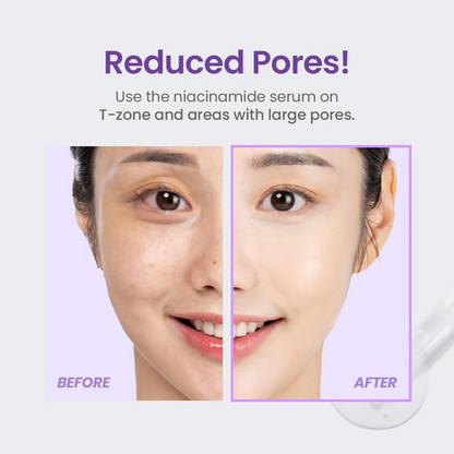 Tirtir Niacinamide 20% Serum
