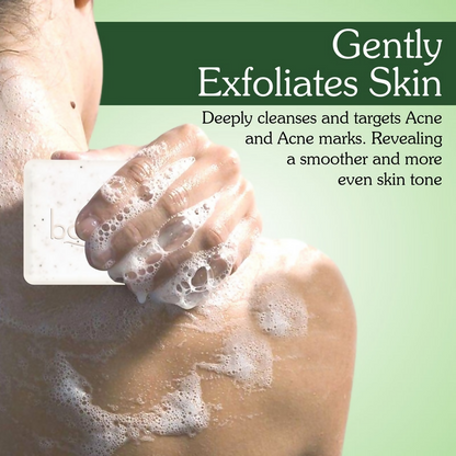 Bake 2% Salicylic Acid Soap for Face & Body Acne