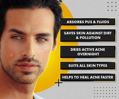 UrbanGabru Acne Pimple Patch - Invisible Facial Stickers Reduces Pimple Overnight