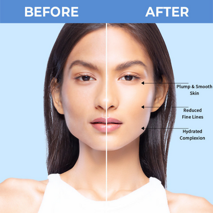 Nykaa SkinRX 2% Hyaluronic Acid Face Serum