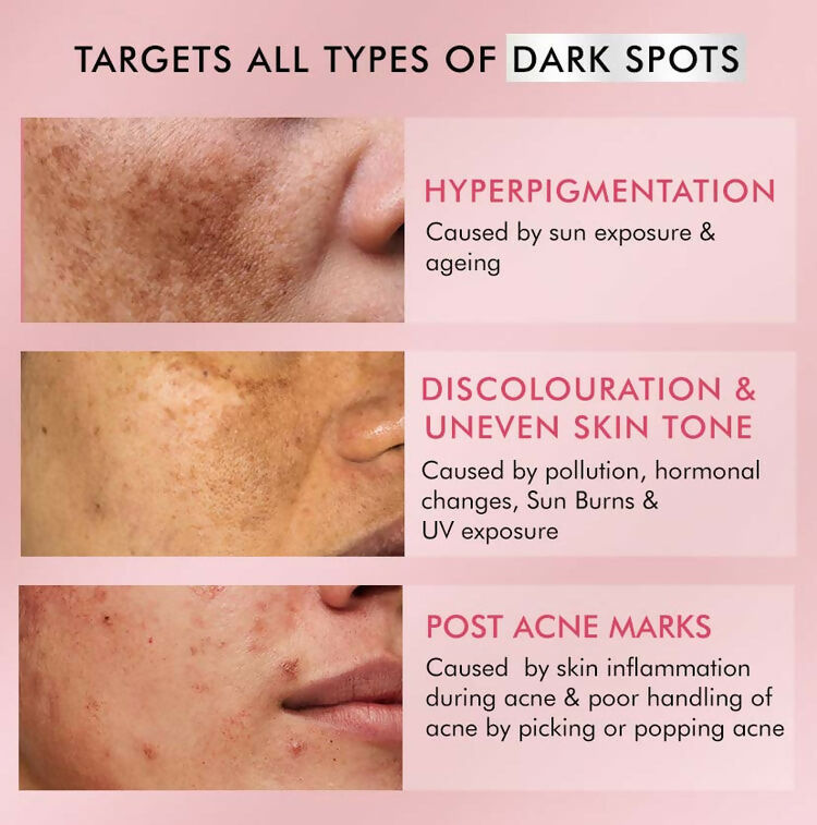 mCaffeine Clear Glow 2% Kojic Acid,1% Niacinamide De-Pigmentation Cream