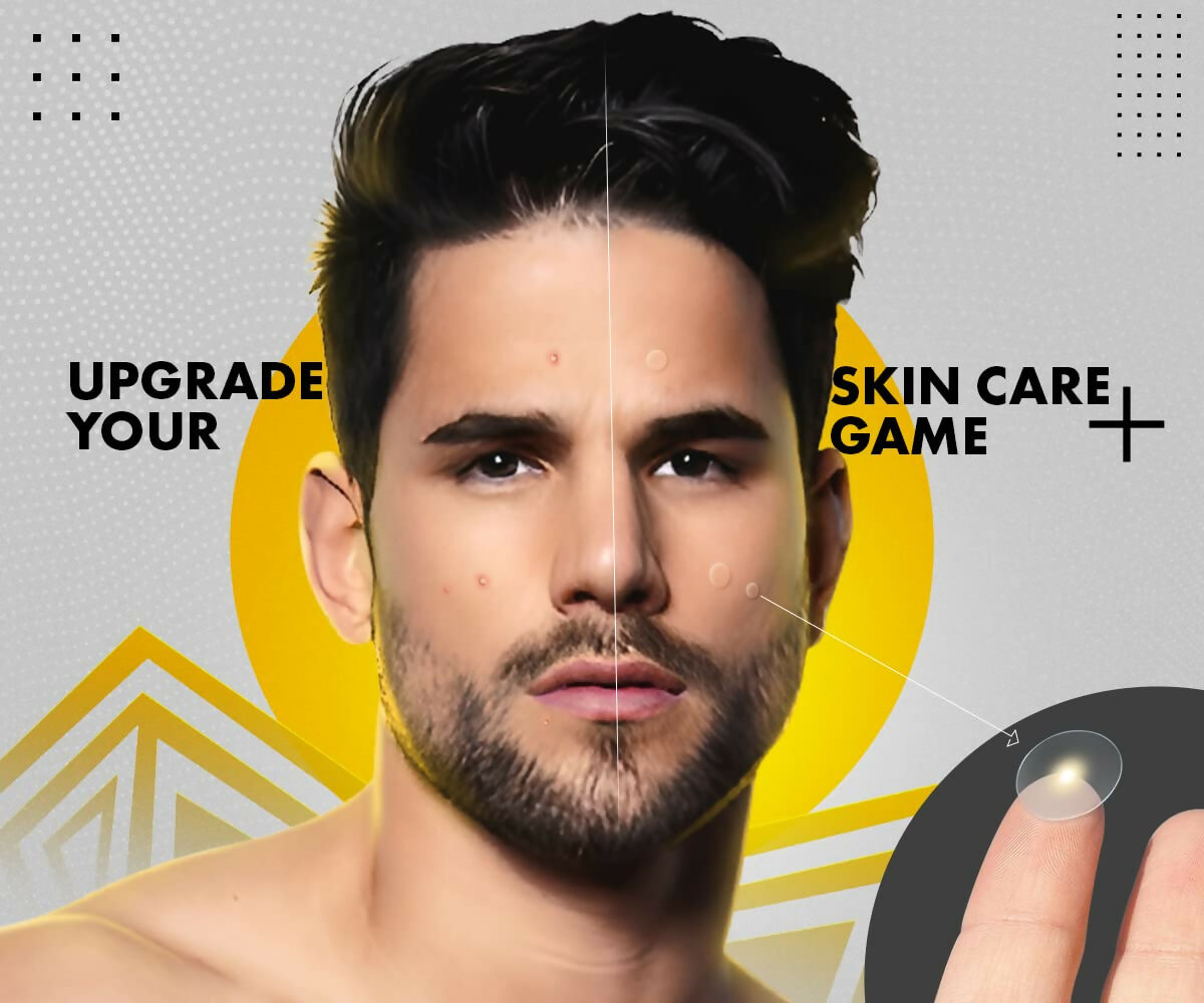 UrbanGabru Acne Pimple Patch - Invisible Facial Stickers Reduces Pimple Overnight