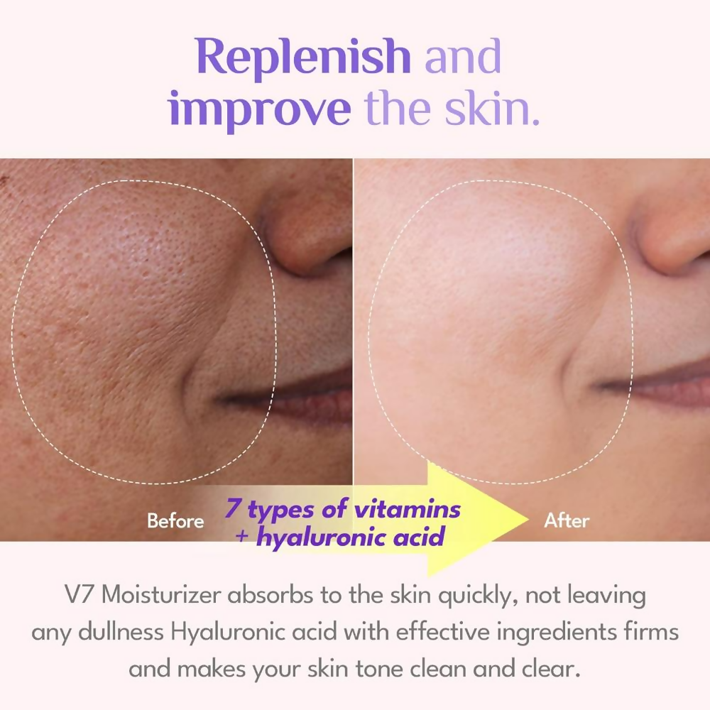 It's Skin V7 Hyaluronic Moisturizer