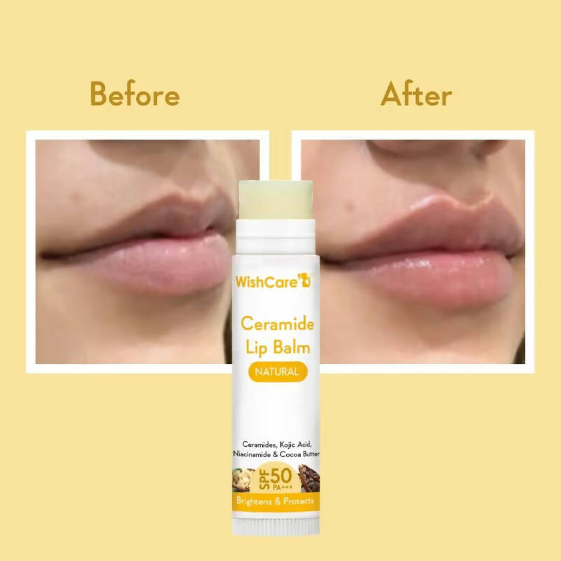 Wishcare Ceramide Lip Balm with SPF50 PA+++ - Natural - Drmedicart
