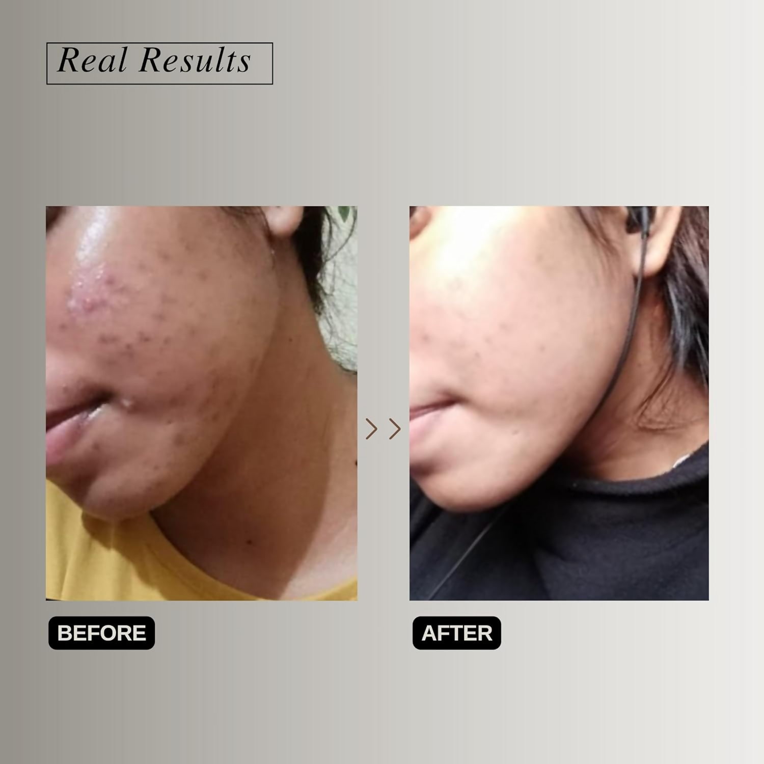 The Formularx Vitamin C Brightening Serum With Arbutin & Nag For Glowing Skin
