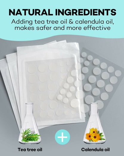 TKTK Acne Patch Pimple Patch - Acne Absorbing Cover Patch, Hydrocolloid Invisible Acne Patches For Face Zit Patch Acne Dots Tea Tree, Calendula Oil