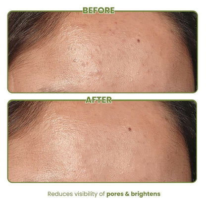The Skin Diet Company Matcha Green Tea Toner Hydrates, Clarifies Pores, Alcohol-Free, For Oily Skin