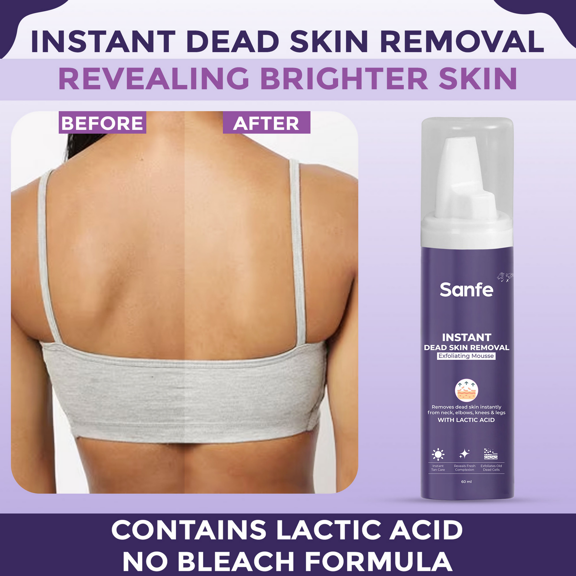 Sanfe Instant Dead Skin Removal Exfoliating Mousse