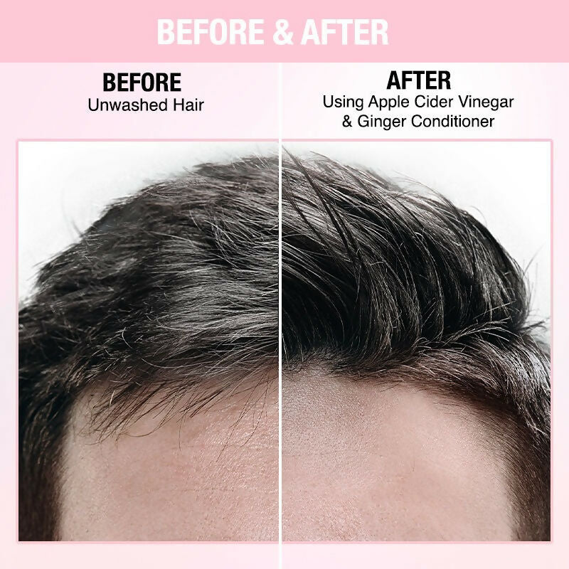 Nykaa Naturals Anti-Dandruff-Free Conditioner With Apple Cider Vinegar & Ginger - Drmedicart