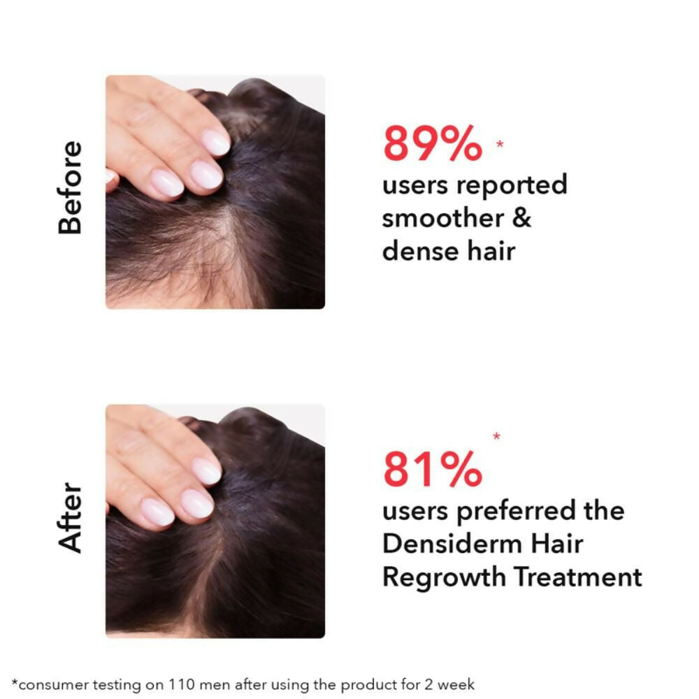 Professional O3+ Women Densiderm Anti Hair Loss Shampoo For Dense Hair & Regrowth