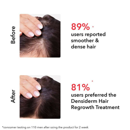 Professional O3+ Women Densiderm Anti Hair Loss Shampoo For Dense Hair & Regrowth